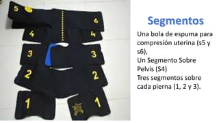 Una bola de espuma para
compresión uterina (s5 y
s6),
Un Segmento Sobre
Pelvis (S4)
Tres segmentos sobre
cada pierna (1, 2 y 3).
 