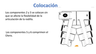 Los componentes 2 y 3 se colocan sin
que se afecte la flexibilidad de la
articulación de la rodilla.
Los componentes 5 y 6 comprimen el
Útero.
 