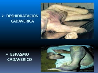  DESHIDRATACION
CADAVERICA
 ESPASMO
CADAVERICO
 