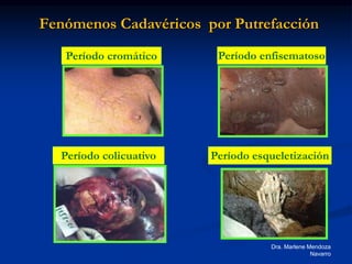 Dra. Marlene Mendoza
Navarro
Fenómenos Cadavéricos por Putrefacción
Período cromático Período enfisematoso
Período esqueletización
Período colicuativo
 