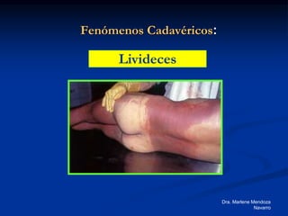 Dra. Marlene Mendoza
Navarro
Fenómenos Cadavéricos:
Livideces
 