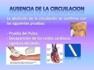 Deshidratación del Globo Ocular: Al fallecer la persona se inicia la deshidratación o pérdida de líquidos que se nota fácilmente en el ojo.