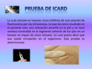 Tinte Gleroso del Ojo: El ojo de la persona muerta se torna opaco y de color gris pizarra.SIGNOS ABIOTICOS INMEDIATOSSon los que sirven para diagnosticar la muerte ocurrida inmediatamente, señalan la ruptura definitiva e irreversible del equilibrio de las funciones fundamentales: SISTEMA NERVIOSO, SISTEMA CARDIO-CIRCULATORIO SISTEMA RESPIRATORIO.