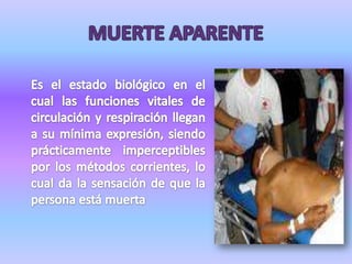 MUERTE APARENTEEs el estado biológico en el cual las funciones vitales de circulación y respiración llegan a su mínima expresión, siendo prácticamente imperceptibles por los métodos corrientes, lo cual da la sensación de que la persona está muerta