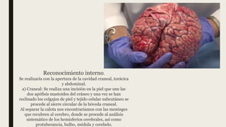 Reconocimiento interno.
Se realizaría con la apertura de la cavidad craneal, torácica
y abdominal.
a) Craneal: Se realiza una incisión en la piel que une las
dos apófisis mastoides del cráneo y una vez se han
reclinado los colgajos de piel y tejido celular subcutáneo se
procede al sierre circular de la bóveda craneal.
Al separar la calota nos encontraríamos con las meninges
que recubren al cerebro, donde se procede al análisis
sistemático de los hemisferios cerebrales, así como
protuberancia, bulbo, médula y cerebelo.
 