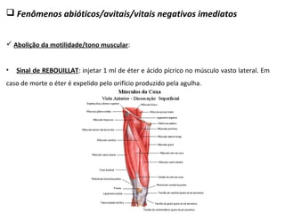 Fenômenos abióticos/avitais/vitais negativos imediatos
 Abolição da motilidade/tono muscular:
• Sinal de REBOUILLAT: injetar 1 ml de éter e ácido pícrico no músculo vasto lateral. Em
caso de morte o éter é expelido pelo orifício produzido pela agulha.
 