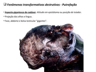 Fenômenos transformativos destrutivos - Putrefação
• Aspecto gigantesco do cadáver: Atitude em epistótomo ou posição de lutador.
• Projeção dos olhos e língua.
• Face, abdome e bolsa testicular “gigantes”.
 