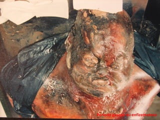 Período gasoso ou enfizematoso
 