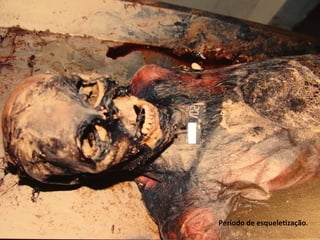 Período de esqueletização.
 