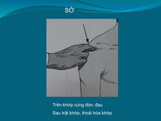 SỜ
Trên khớp cùng đòn: đau
Sau trật khớp, thoái hóa khớp
 