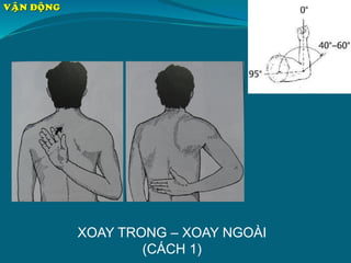 XOAY TRONG – XOAY NGOÀI
(CÁCH 1)
VAÄN ÑOÄNG
 