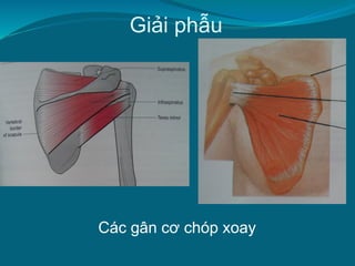 Giải phẫu
Các gân cơ chóp xoay
 
