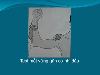 Test mất vững gân cơ nhị đầu
 