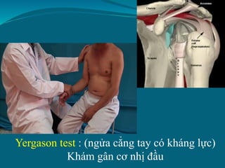 Yergason test : (ngửa cẳng tay có kháng lực)
Khám gân cơ nhị đầu
 