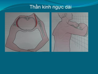 Thần kinh ngực dài
 