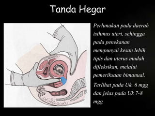 Tanda Hegar
Perlunakan pada daerah
isthmus uteri, sehingga
pada penekanan
mempunyai kesan lebih
tipis dan uterus mudah
difleksikan, melalui
pemeriksaan bimanual.
Terlihat pada Uk. 6 mgg
dan jelas pada Uk 7-8
mgg
 