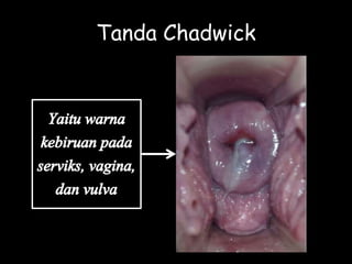 Tanda Chadwick
 