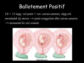 Ballotement Positif
Uk > 12 mgg, vol janin < vol. cairan amnion, shgg tek.
mendadak @ uterus → janin tenggelam dlm cairan amnion
→ memantul ke sisi semula
 