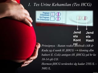 1. Tes Urine Kehamilan (Tes HCG)
Jend
ela
Kont
rol
Jend
ela
Hasil
Prinsipnya : Ikatan reaksi antibodi (AB dr
Kuda yg d suntk H. ßHCG → kloning dlm
bakteri E. Coli) antigen (H. ßHCG) pd hr ke
10-14 sjk CO.
Hormon ßHCG terdeteksi dg kadar 25IU/L –
50IU/L.
 