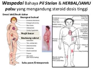 Waspadai Bahaya Pil Stelan & HERBAL/JAMU
  palsu yang mengandung steroid dosis tinggi
Emosi labil/Beuki dahar
                Beungeut buleud




               Peujit bocor
               Beuteung cabrut




                Suku pacer/Osteoporosis
 