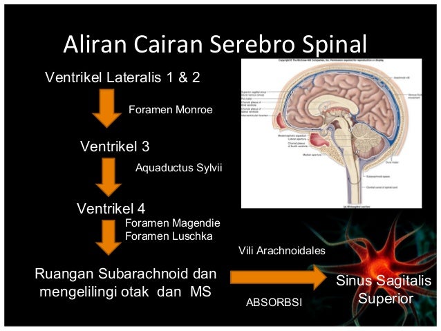 Peningkatan Tekanan IntraCranial