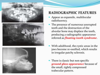 Tanishq OMR Seminar bone diseases third year bds | PDF