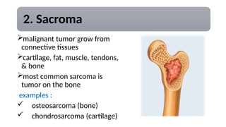 Sarcoma Example CANCER PRESENTATION AND THEORY AND AWARENESS | PPTX