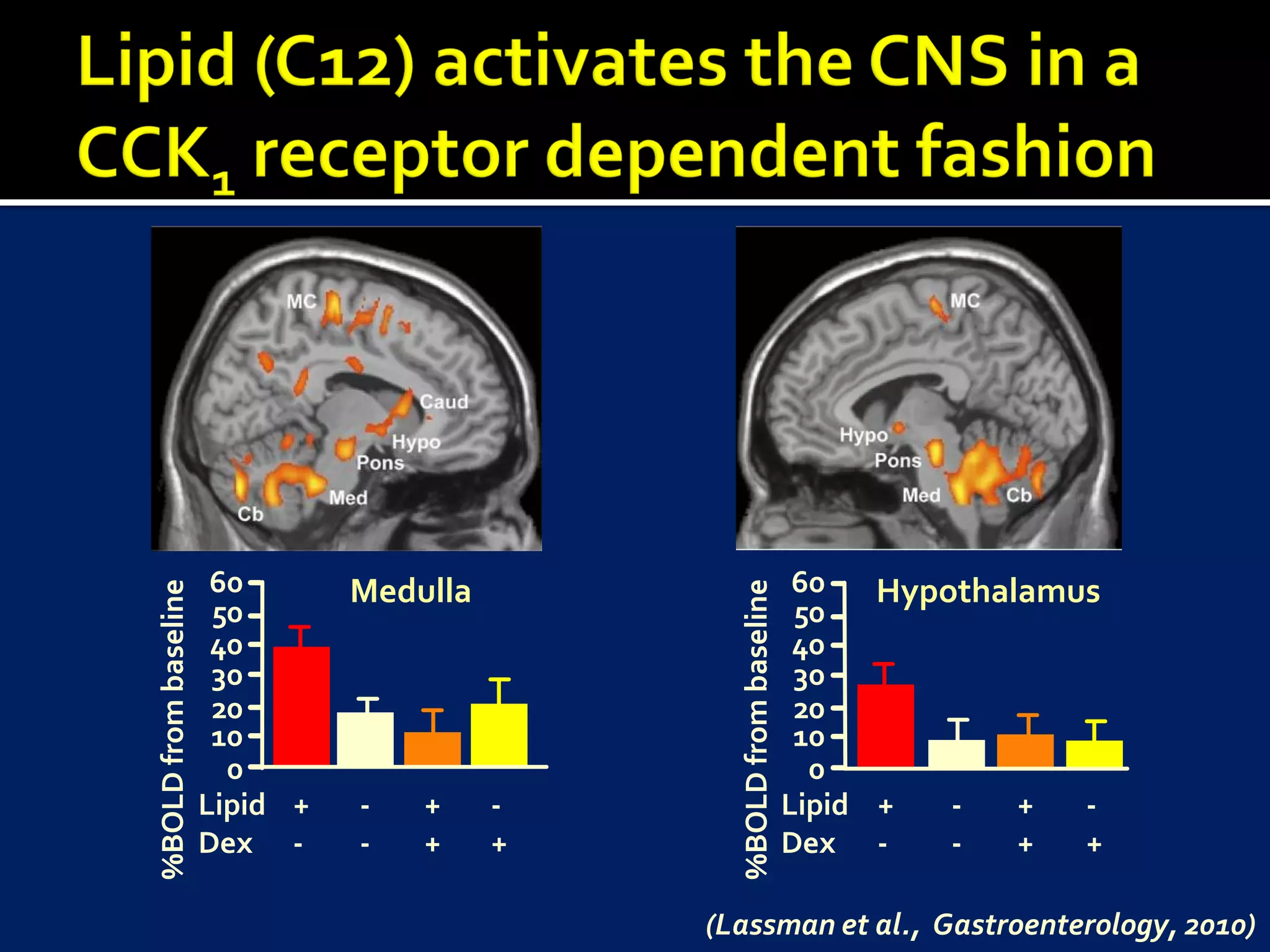 60       Medulla                                60   Hypothalamus
%BOLD from baseline




                                                %BOLD from baseline
                       50                                              50
                       40                                              40
                       30                                              30
                       20                                              20
                       10                                              10
                        0                                               0
                      Lipid +   -   +     -                           Lipid +   -   +  -
                      Dex -     -   +     +                           Dex -     -   +  +

                                              (Lassman et al., Gastroenterology, 2010)
 