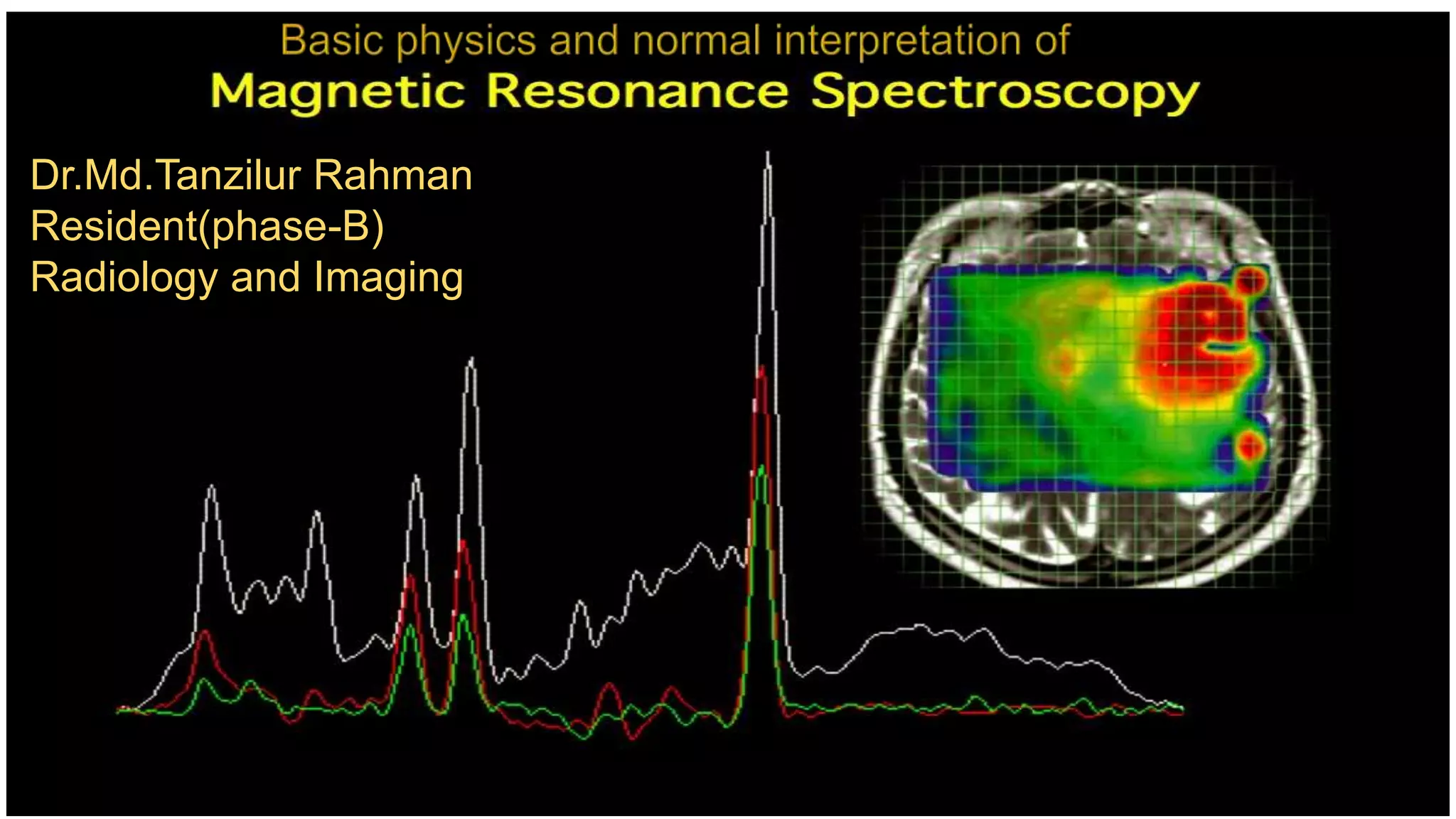 Dr.Md.Tanzilur Rahman
Resident(phase-B)
Radiology and Imaging
 