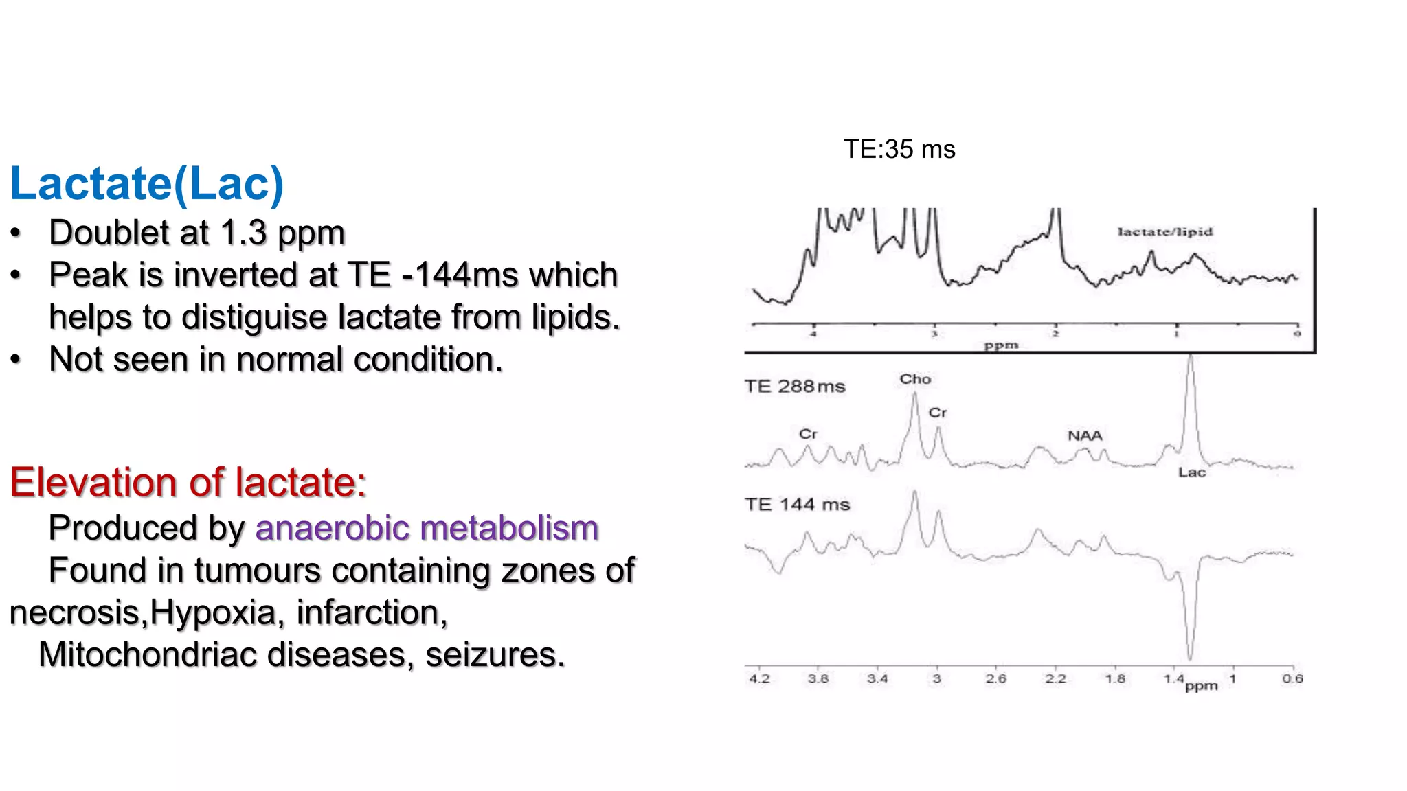 Lactate(Lac)
• Doublet at 1.3 ppm
• Peak is inverted at TE -144ms which
helps to distiguise lactate from lipids.
• Not seen in normal condition.
Elevation of lactate:
Produced by anaerobic metabolism
Found in tumours containing zones of
necrosis,Hypoxia, infarction,
Mitochondriac diseases, seizures.
TE:35 ms
 