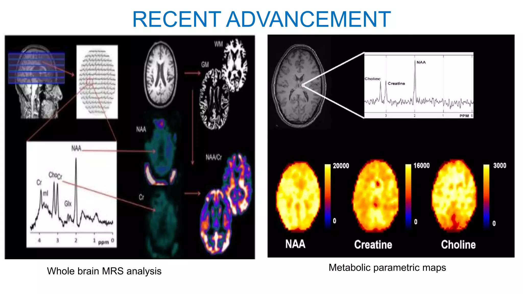 RECENT ADVANCEMENT
Whole brain MRS analysis Metabolic parametric maps
 