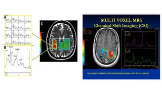 Mrs. Brain Example Basic physics and normal interpretation of MRS | PPTX