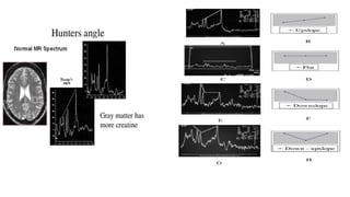Basic physics and normal interpretation of MRS | PPTX