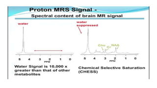 Basic physics and normal interpretation of MRS | PPTX