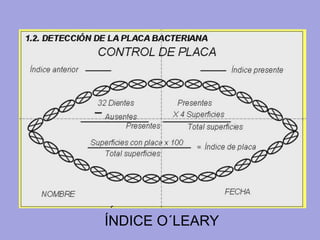 ÍNDICE O´LEARY
 