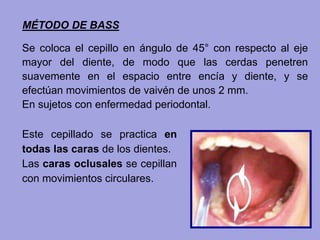 MÉTODO DE BASS
Este cepillado se practica en
todas las caras de los dientes.
Las caras oclusales se cepillan
con movimientos circulares.
Se coloca el cepillo en ángulo de 45° con respecto al eje
mayor del diente, de modo que las cerdas penetren
suavemente en el espacio entre encía y diente, y se
efectúan movimientos de vaivén de unos 2 mm.
En sujetos con enfermedad periodontal.
 