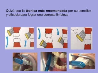 Quizá sea la técnica más recomendada por su sencillez
y eficacia para lograr una correcta limpieza
 