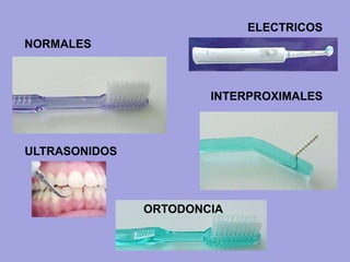ULTRASONIDOS
ELECTRICOS
INTERPROXIMALES
NORMALES
ORTODONCIA
 