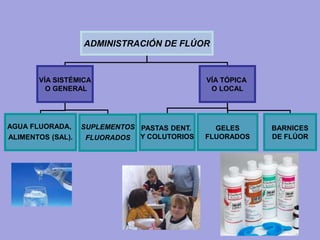 ADMINISTRACIÓN DE FLÚOR
VÍA SISTÉMICA
O GENERAL
VÍA TÓPICA
O LOCAL
AGUA FLUORADA,
ALIMENTOS (SAL).
SUPLEMENTOS
FLUORADOS
PASTAS DENT.
Y COLUTORIOS
GELES
FLUORADOS
BARNICES
DE FLÚOR
 