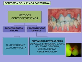 DETECCIÓN DE LA PLACA BACTERIANA
MÉTODOS
DETECCIÓN DE PLACA
PROCEDIMIENTOS
FÍSICOS
PROCEDIMIENTOS
QUÍMICOS
FLUORESCEÍNA Y
LUZ ULTRAVIOLETA
SUSTANCIAS REVELADORAS
DE PLACA: ERITROSINA, EOSINA,
VIOLETA DE GENCIANA,
VIOLETA DISPLAY,
VERDE MALAQUITA
 