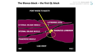 Source: LSORA > The Blanco block: a Quadratus lumborum block
The Blanco block – the first QL block
 