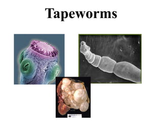 Tapeworms
 