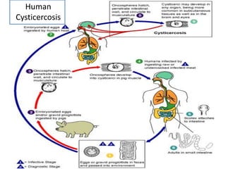 Human
Cysticercosis
 