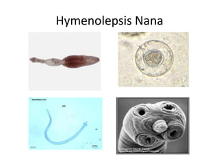 Hymenolepsis Nana
 