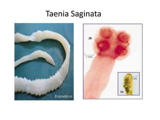 Taenia Saginata
 