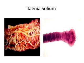 Taenia Solium
 
