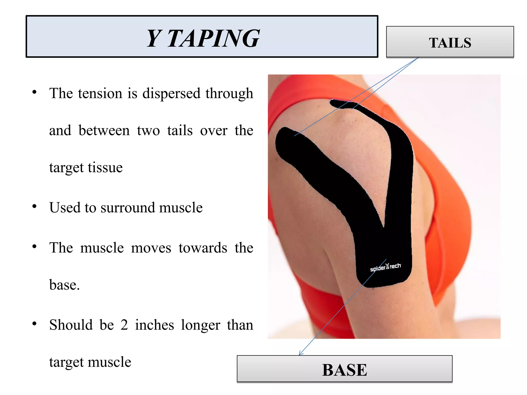 Y TAPING
• The tension is dispersed through
and between two tails over the
target tissue
• Used to surround muscle
• The muscle moves towards the
base.
• Should be 2 inches longer than
target muscle
BASEBASE
TAILSTAILS
 