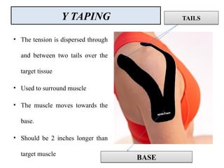 Y TAPING
• The tension is dispersed through
and between two tails over the
target tissue
• Used to surround muscle
• The muscle moves towards the
base.
• Should be 2 inches longer than
target muscle
BASEBASE
TAILSTAILS
 