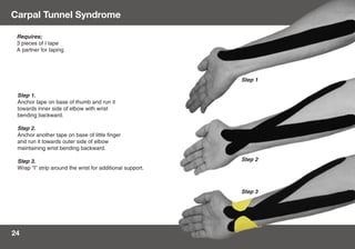 Taping Guide | PDF