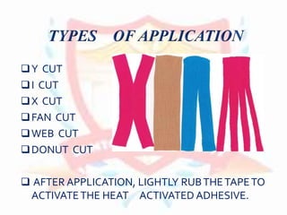 Y CUT
I CUT
X CUT
FAN CUT
WEB CUT
DONUT CUT
 AFTER APPLICATION, LIGHTLY RUBTHETAPETO
ACTIVATETHE HEAT ACTIVATED ADHESIVE.
 